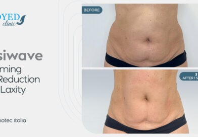 عيادة Medyed تجربة شاملة للعلاجات التجميلية والعافية المتقدمة